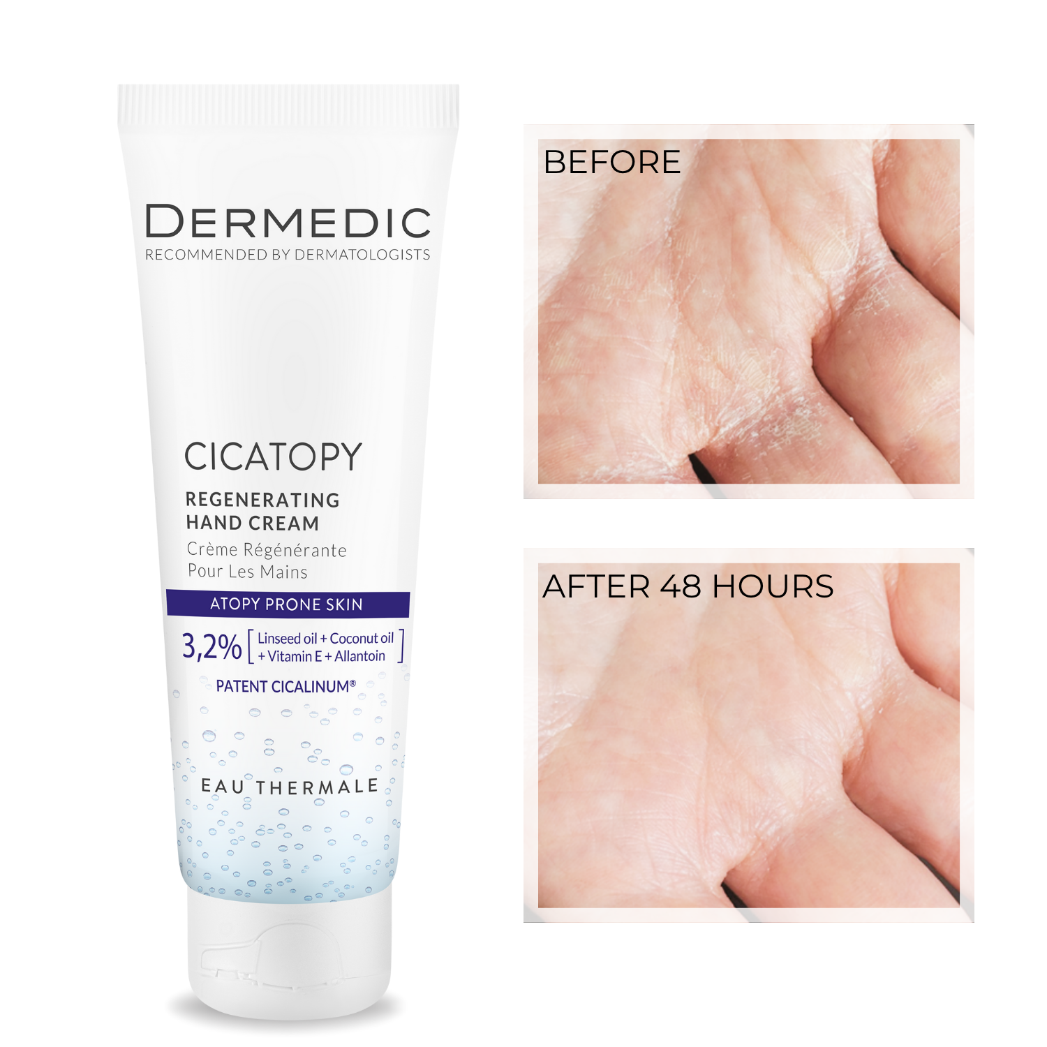 CICATOPY regenerating hand cream